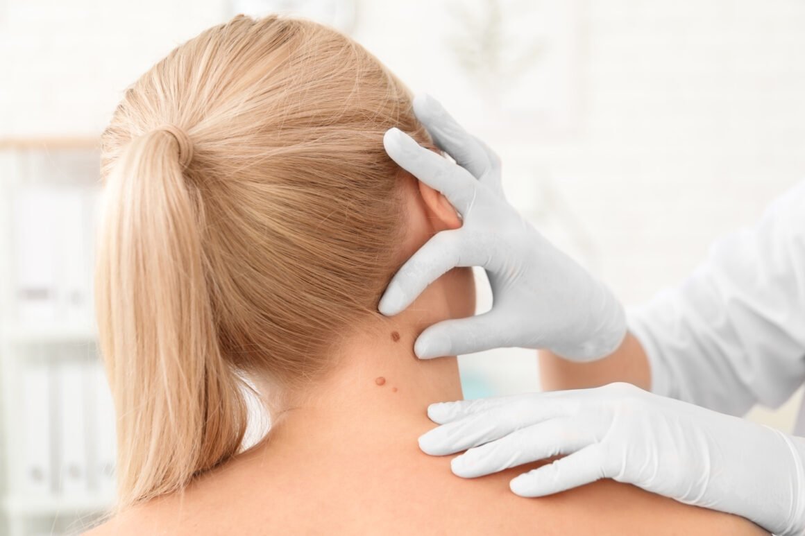 DERMATOVENEROLOGS
