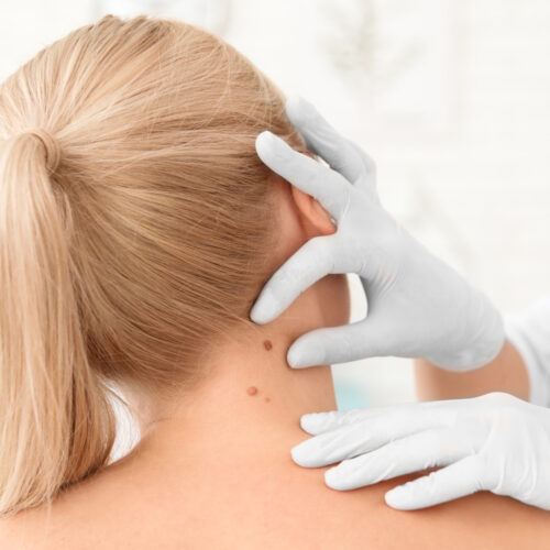 DERMATOVENEROLOGS