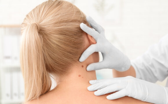 DERMATOVENEROLOGS DERMATOVENEROLOGS